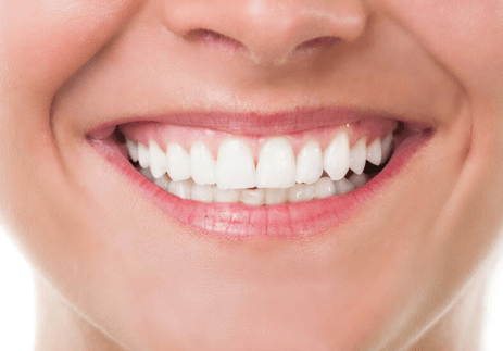 natural teeth